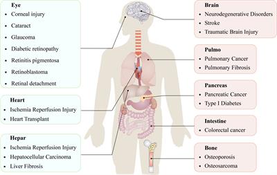 Ferroptosis: a novel mechanism of cell death in ophthalmic conditions